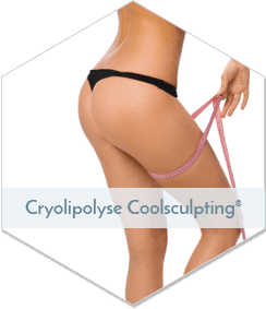 Cryolipolyse